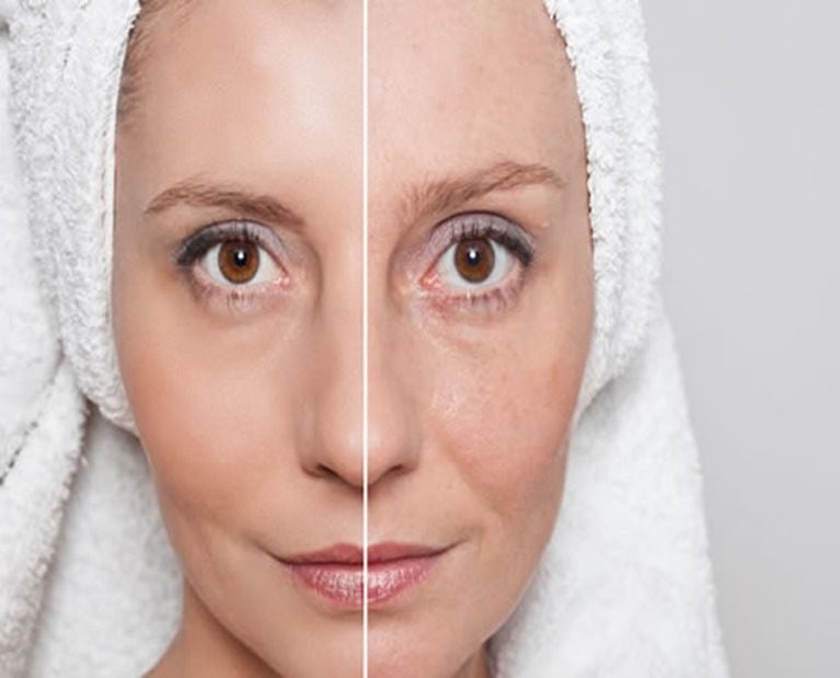 What-is-skin-laxity-Facial-Skin-Tightening-Firming-Cyprus-Derma-Clinic-Yiannis-Neophytou-1-e1547215933202 (1)